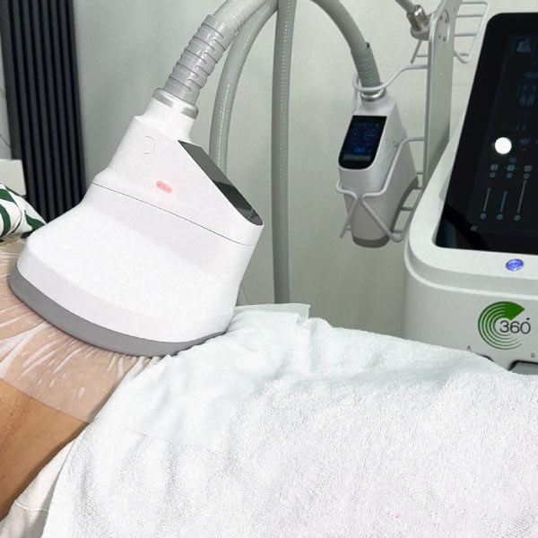 eseal-cryotherapie-2