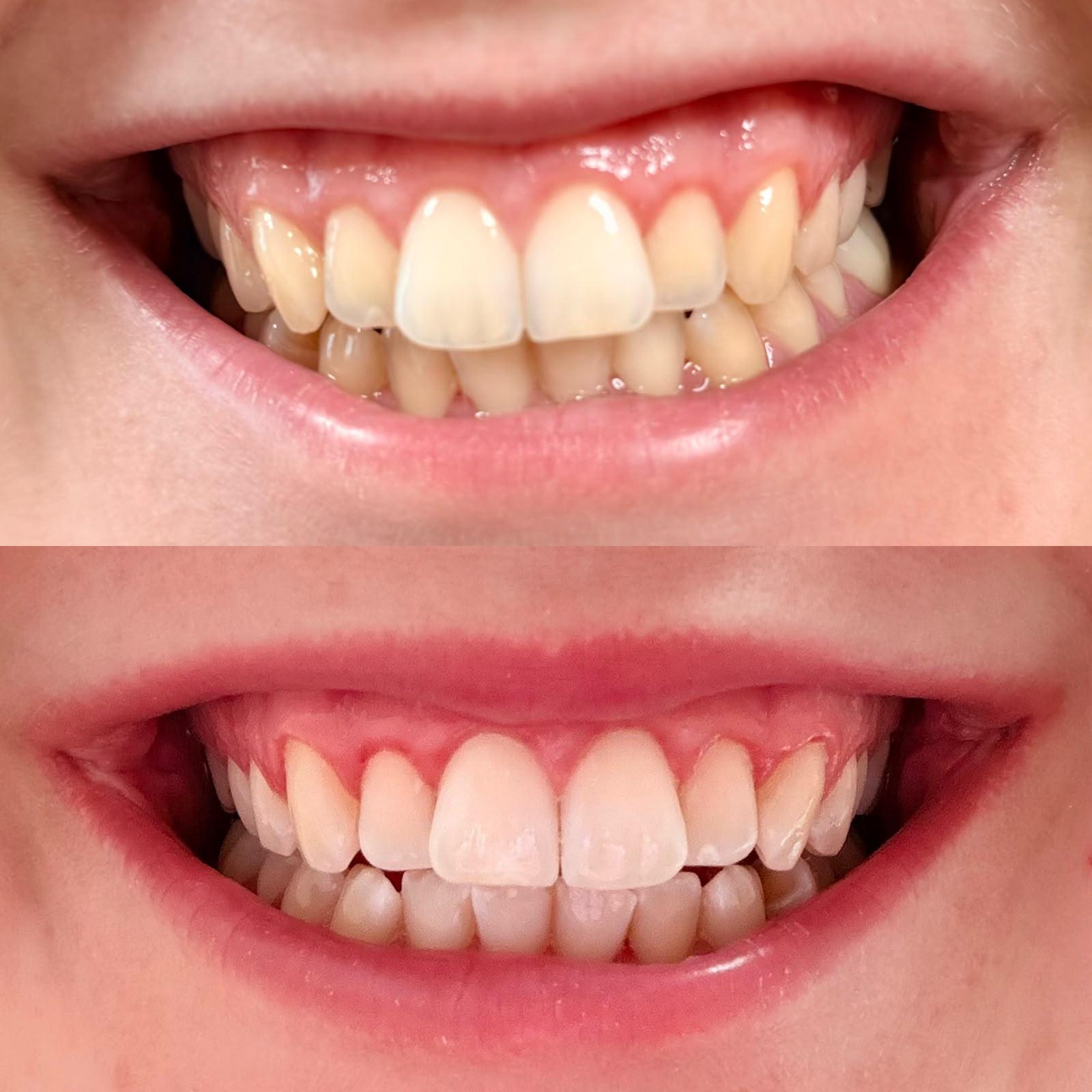 Dentaire 1 | Eseal Wellness, Votre havre de beauté et de bien-être à Wavre